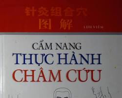 Hình ảnh về Học viên thực hành châm cứu